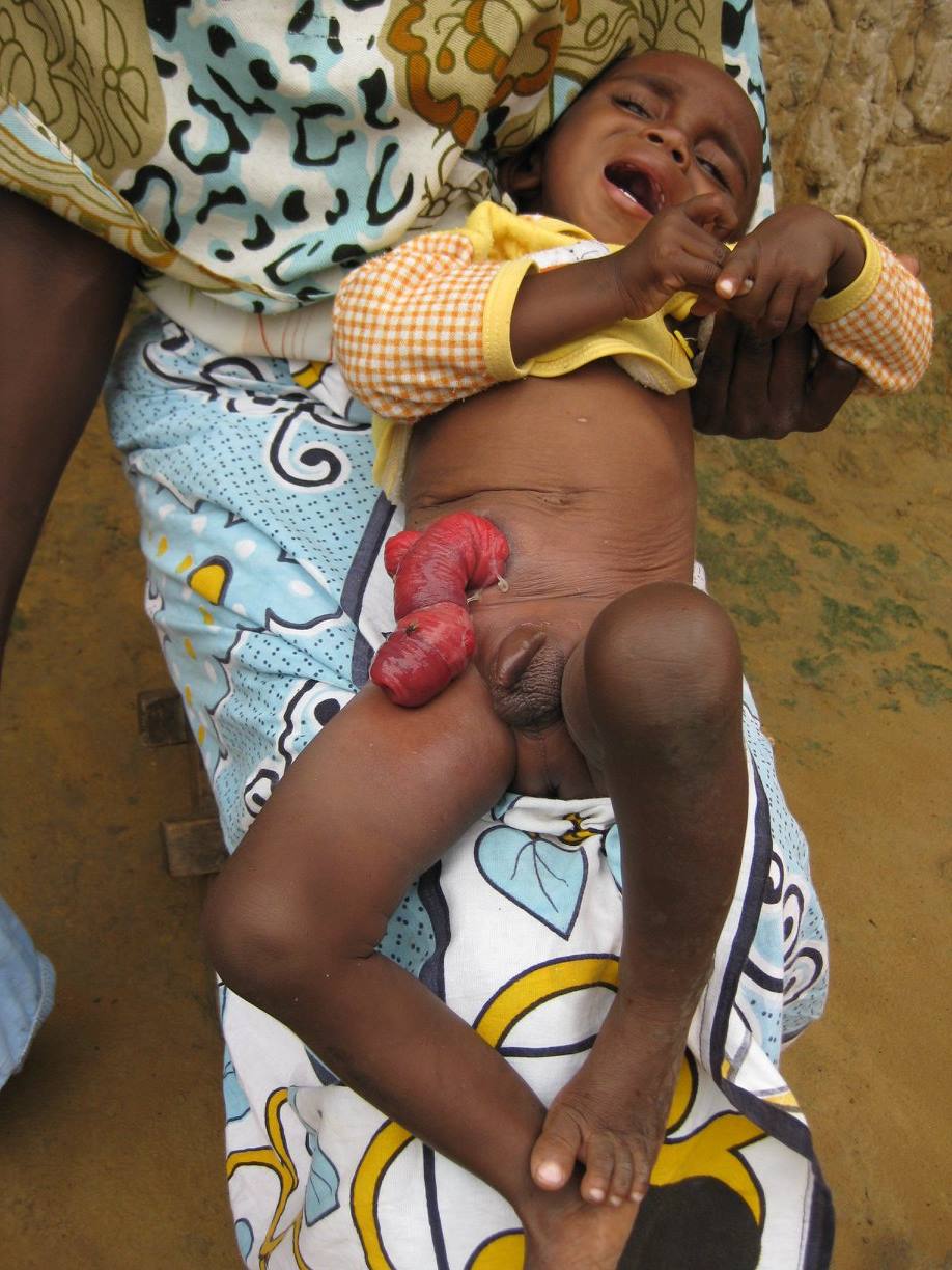 Help Save Children in Kilifi: Restore Health and Hope